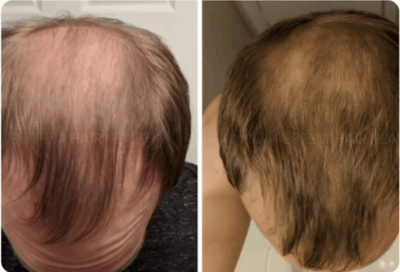 Roota Hair Serum Customer ~James K.